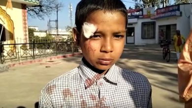 image 12 देर से पंहुचा स्कूल तो शिक्षक ने जल्लाद की तरह डंडे से पीटा, खून से रंग गई मासूम की शर्ट