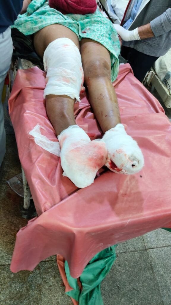 Road Accident : रायपुर में महिला पत्रकार को ट्रेलर ने कुचला, हालत गंभारी 2 1006276012 Road Accident : रायपुर में महिला पत्रकार को ट्रेलर ने कुचला, हालत गंभारी