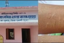 IMG 20260219 164502 धमतरी में 35 सरकारी स्कूल के छात्रों ने कलाई काटी, ‘नकल करने’ की आशंका; जांच जारी