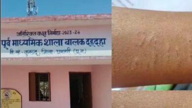 धमतरी में 35 सरकारी स्कूल के छात्रों ने कलाई काटी, ‘नकल करने’ की आशंका; जांच जारी 5 IMG 20260219 164502 धमतरी में 35 सरकारी स्कूल के छात्रों ने कलाई काटी, ‘नकल करने’ की आशंका; जांच जारी