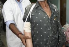 IMG 20261011 WA0029 ट्रेन हादसे के दर्द पर 'सेवा संकल्प' का मरहम, धमतरी के तेजराम को दो घंटे में मिला कृत्रिम हाथ, लौटी जिंदगी की रंगत
