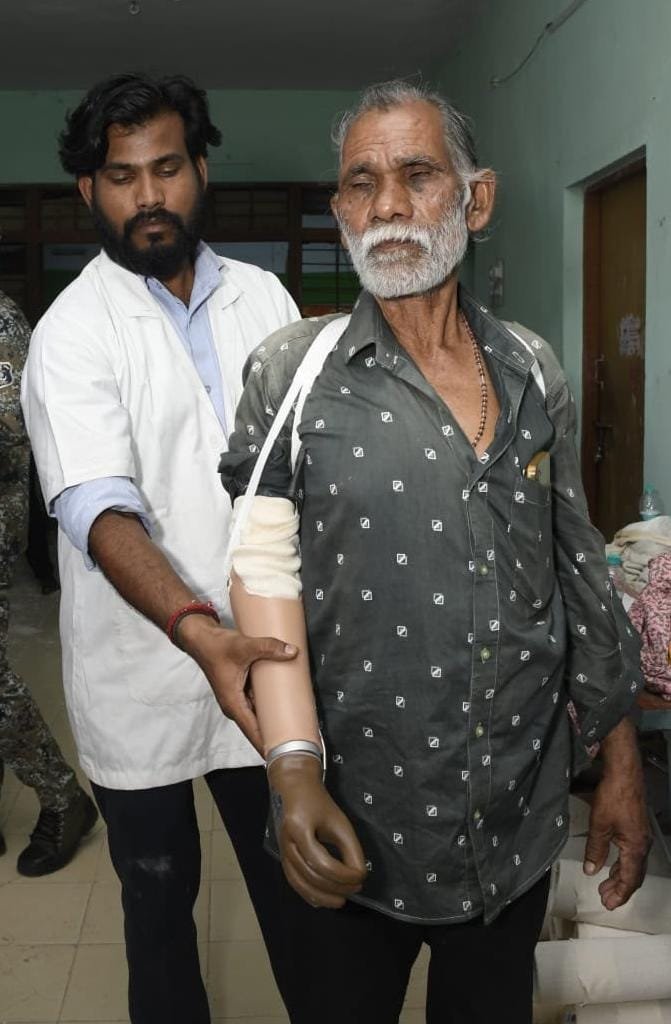 IMG 20261011 WA0029 ट्रेन हादसे के दर्द पर 'सेवा संकल्प' का मरहम, धमतरी के तेजराम को दो घंटे में मिला कृत्रिम हाथ, लौटी जिंदगी की रंगत